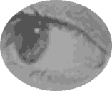 eye